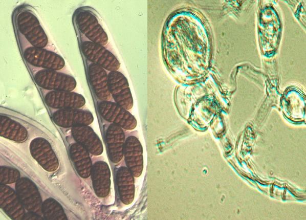 Fotos microscopio de ascas bitunicada y prototunicada